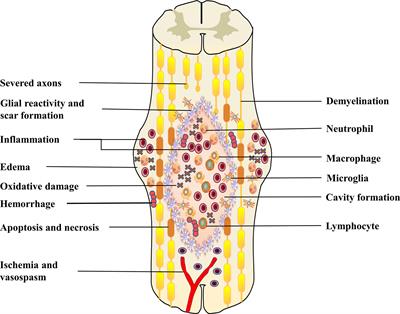 Advances in the research of the role of macrophage/microglia polarization-mediated inflammatory response in spinal cord injury
